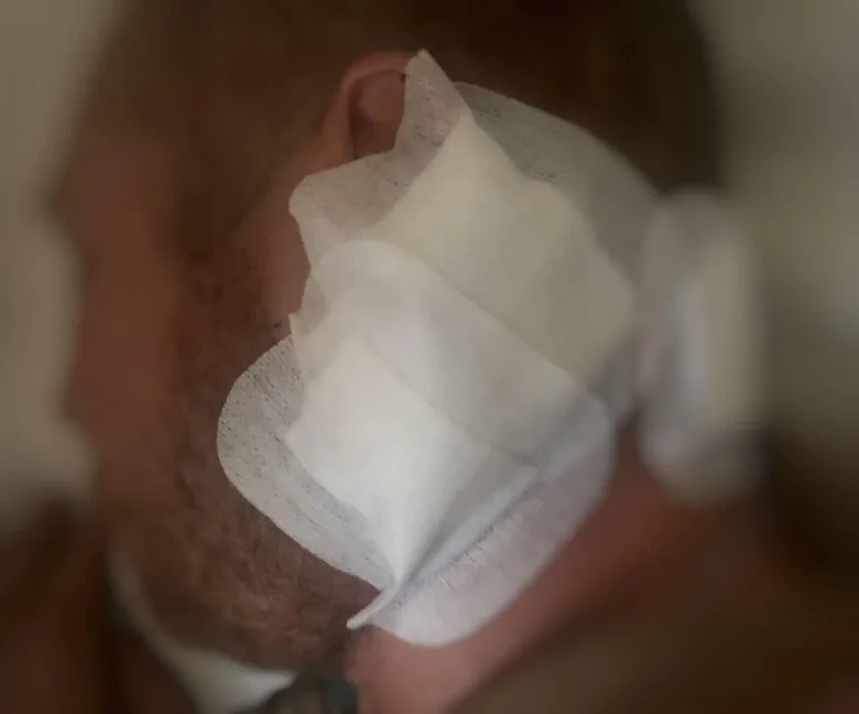 Снайпер влучив в голову: у Дніпрі врятувати життя військовому ЗСУ