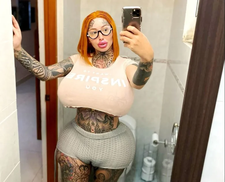 У Instagram-моделі лопнув імплант в груді